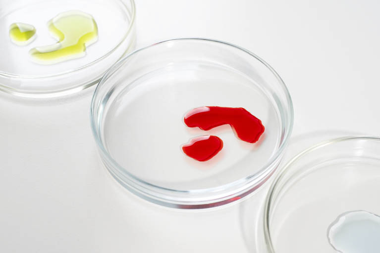 Hemochromatosis Symptoms and Risk Factors: Signs You Should Never Ignore